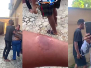 Drama in the Compound: Nigerian Landlady Allegedly Bites Tenant During Heated Argument