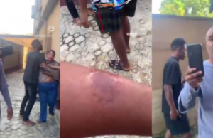 Drama in the Compound: Nigerian Landlady Allegedly Bites Tenant During Heated Argument